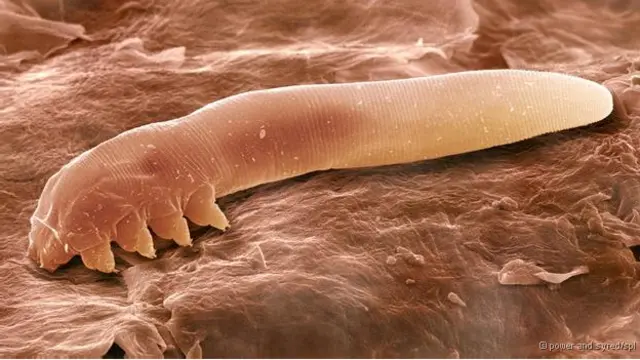 Ácaros no seu corpo: Você não está só. ácaro demodex