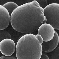 Top 5 Fungos bizarros e seus efeitos inacreditáveis saccharomyces | Bizarro | bizarro, curioso, doenças, fungos, incrível, Uncategorized
