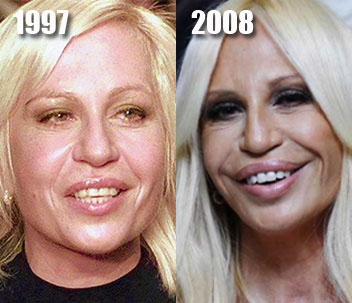 5 Cirurgias plásticas infelizes 500full donatella versace | Bizarro | bizarro, feio, horrível, plastica, sinistro