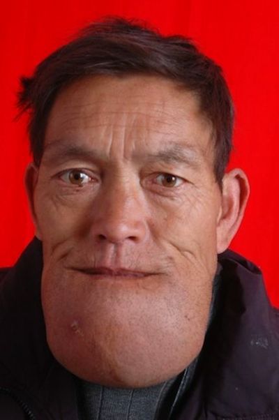 O homem com o maior queixo do mundo worlds biggest chin | Bizarro | bizarro, china, chinês, mutante, sinistro