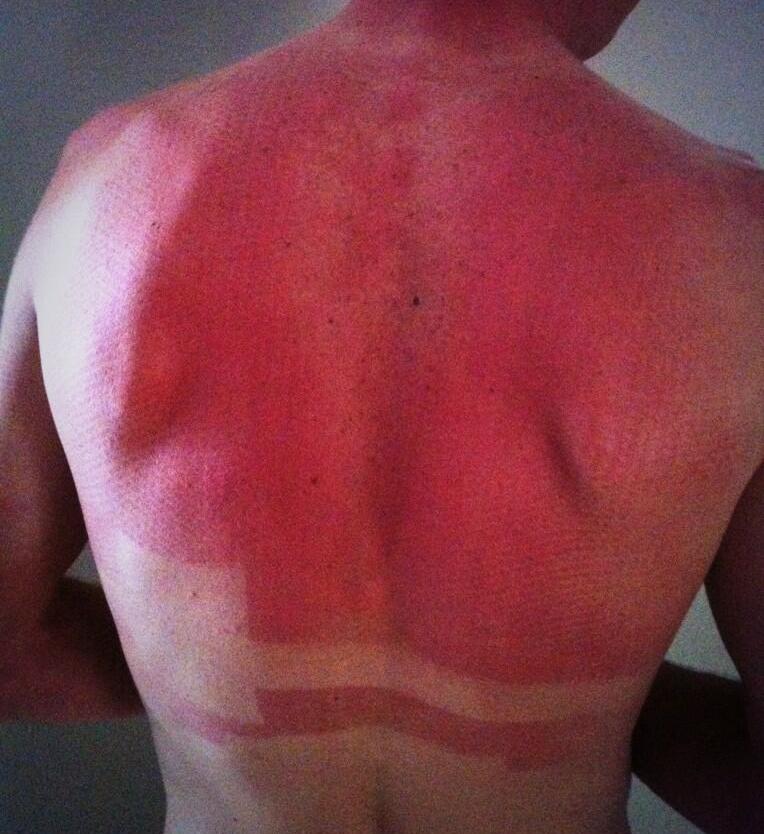 Animais vermelhos Froome sunburn | Animais | animais, bichos, curioso, incrível, vermelho