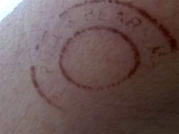 O que são as marcas misteriosas que estão aparecendo nas pessoas? 417707414 10228769067265975 5407961360814085056 n | Bizarro | aliens, curioso, fortianismo, marcasm bizarro, mistério, sinistro, ufo, ufologia
