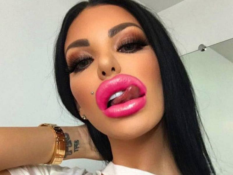 Beiço Monstro: Dez garotas que perderam completamente a noção 180119 20 | Bizarro | bizarro, desastre, horrível, plastica, sinistro