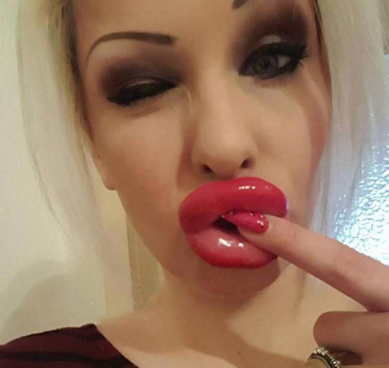Beiço Monstro: Dez garotas que perderam completamente a noção 180119 23 | Bizarro | bizarro, desastre, horrível, plastica, sinistro