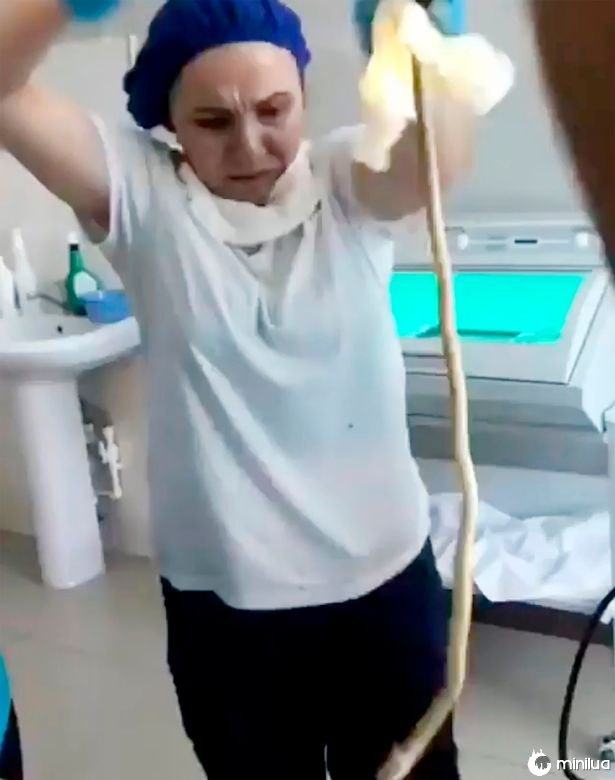 Bizarro: Uma cobra de um metro e vinte foi parar na garganta de uma mulher quando ela dormia 1 PAY Snake crawled into the mouth 4 east2west newss | Bizarro | bizarro, cobra, curioso, medico, sinistro
