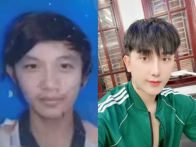 Plástica: Maluco vira outra pessoa após não conseguir arranjar emprego por ser feio demais cosmetic surgery3 | Incrível | bizarro, cirurgia, incrível, plastica