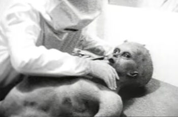 Matilda McElroy: A enfermeira que conversou com o alien de Roswell 170926 alien autopsy 01 | Polêmica | alien, enfermeira, matilda, roswell, ufo