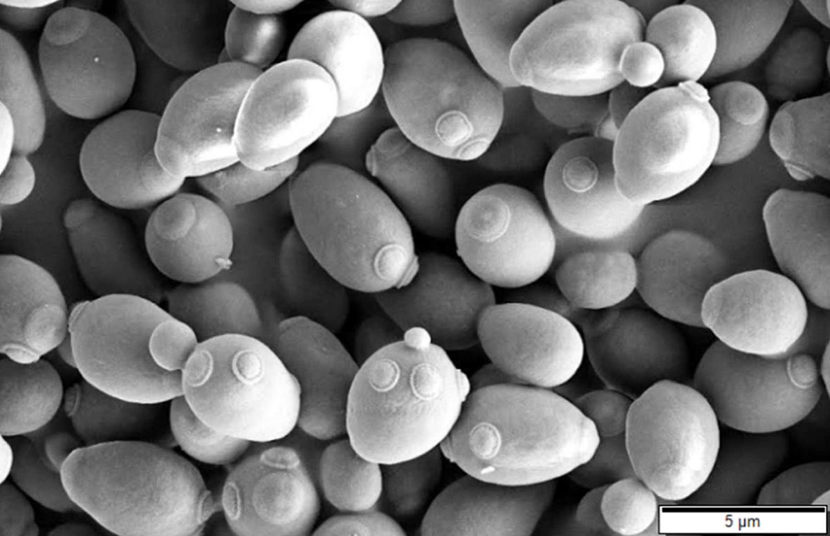 O homem que ficou bêbado após comer um bolo Saccharomyces cerevisiae SEM | Bizarro | bizarro, curioso, doença, esquisito, estranho, incrível