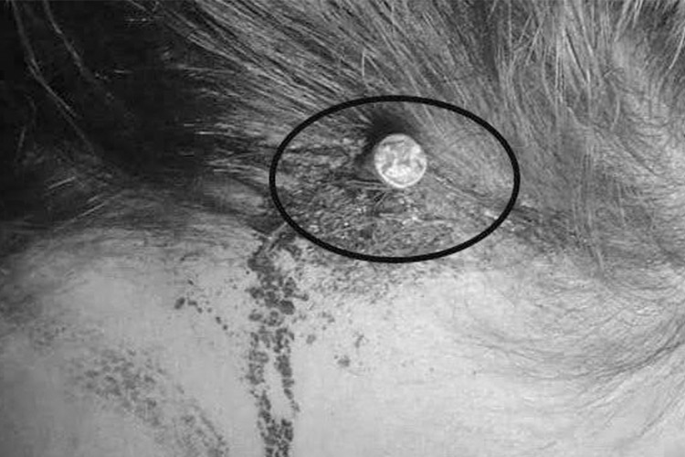 Mulher tem a cabeça pregada para garantir um filho "homi" e bem saudável skull nail2 | Bizarro | absurdo, bizarro, crendice, fé, paquistão