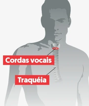 Novidade maluca do momento: Pessoas fazendo plástica na voz cordas vocais Pesquisa Google | Bizarro | bizarro, curioso, medicina, turquia, voz