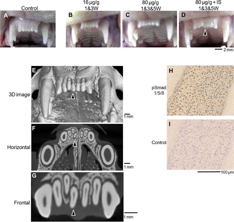 Cientistas descobrem como fazer dentes perdidos crescerem novamente uchyonye nashli sposob zastavit zuby rasti zanovo 1 | Ciência | ciência, curiosidade, odontologia