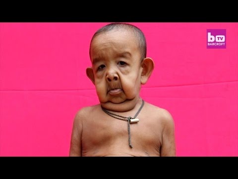 O homem de 25 que parece ter 45, o rapaz de 27 que parece ter 13 e mais casos incríveis hqdefault 15 | Curiosidades | bizarro, curioso, estranho, idade, incrível