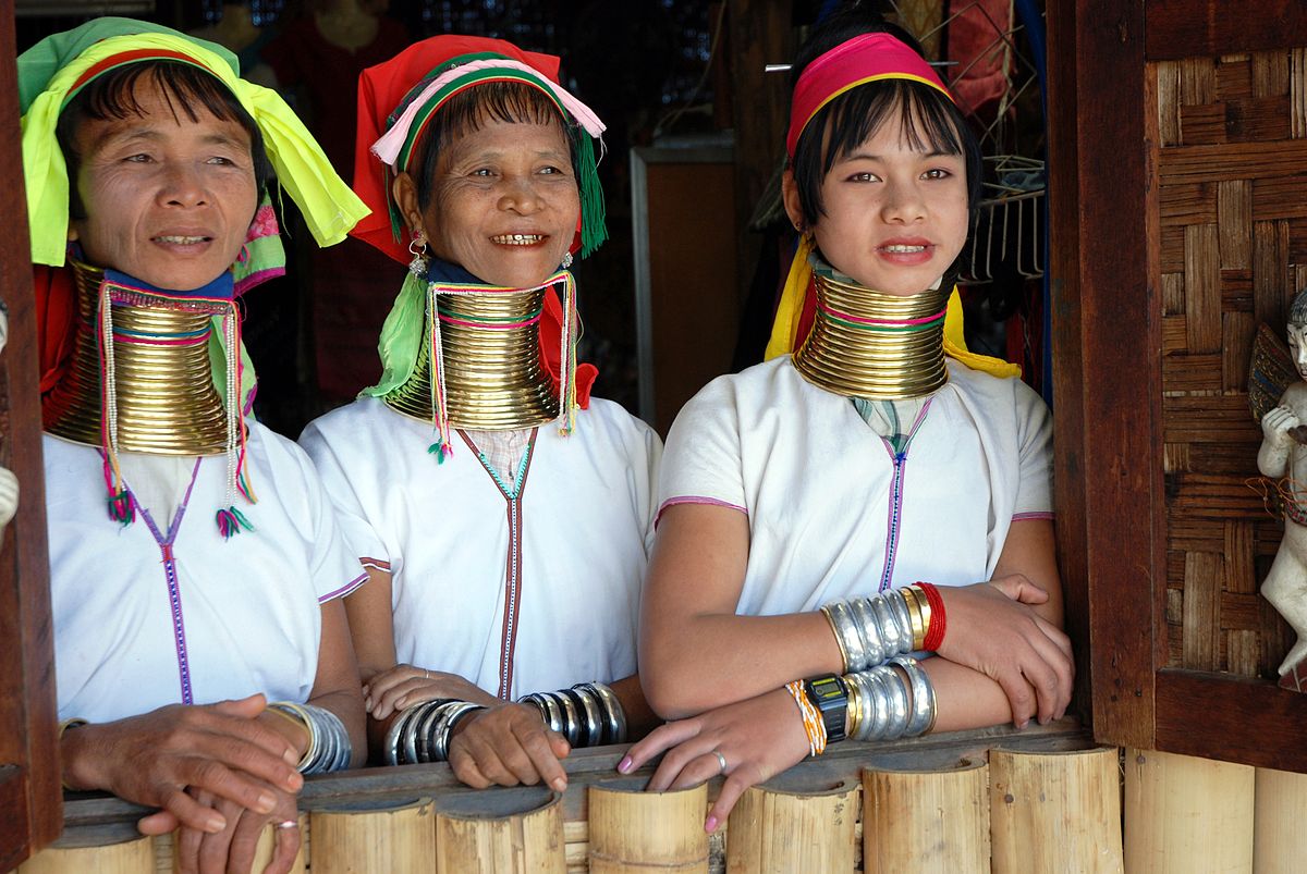Cirurgia que muda a cor do olho: Saiba tudo 1200px Kayan women Burma 1 | Curiosidades | ceratopigmentação, cirurgia, como ficar com o olho azul, curiosidades, dicas, olftalmologia, olho azul, olhos
