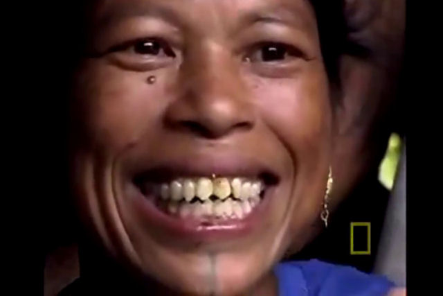Cirurgia que muda a cor do olho: Saiba tudo 27320mn | Curiosidades | ceratopigmentação, cirurgia, como ficar com o olho azul, curiosidades, dicas, olftalmologia, olho azul, olhos