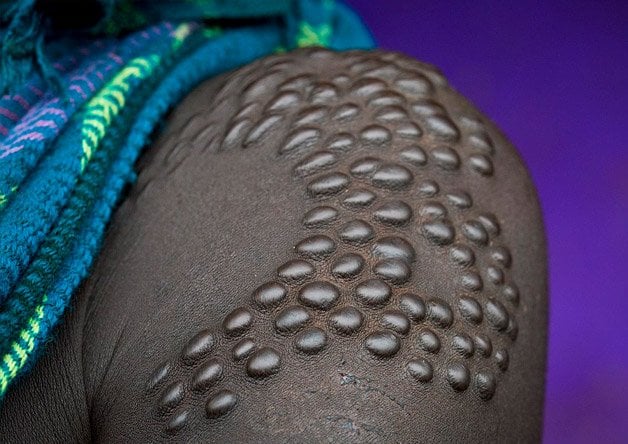 Cirurgia que muda a cor do olho: Saiba tudo africa8 | Curiosidades | ceratopigmentação, cirurgia, como ficar com o olho azul, curiosidades, dicas, olftalmologia, olho azul, olhos
