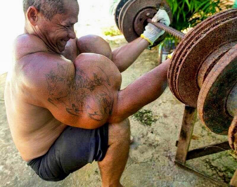 Os abusos do uso de Synthol causam deformidades Os abusos do uso de Synthol causam deformidades