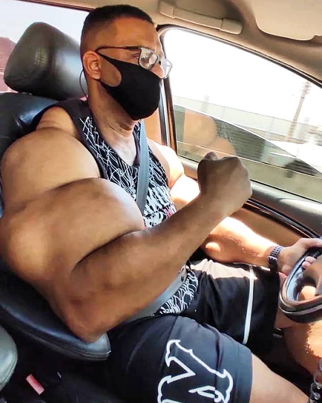Os abusos do uso de Synthol causam deformidades Os abusos do uso de Synthol causam deformidades