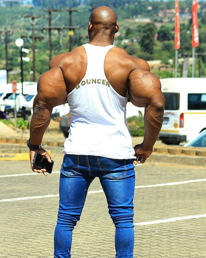 Os abusos do uso de Synthol causam deformidades Os abusos do uso de Synthol causam deformidades