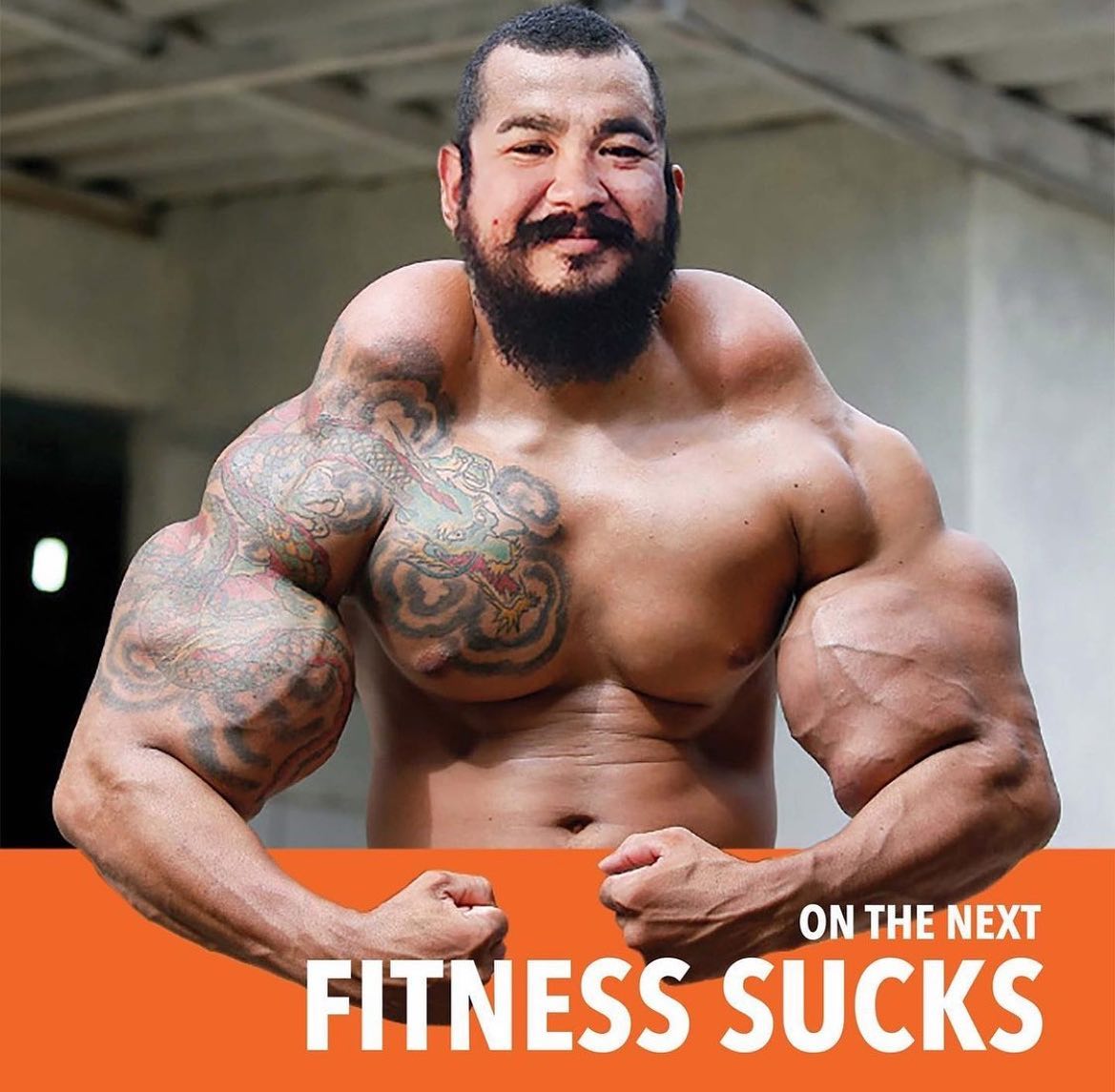 Os abusos do uso de Synthol causam deformidades Os abusos do uso de Synthol causam deformidades