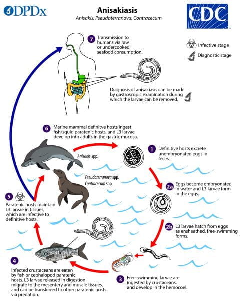A caneta que tem uma lombriga viva dentro anisakiasis lifecycle lg cdc sized pt | Bizarro | bizarro, estranho, japão, parasita