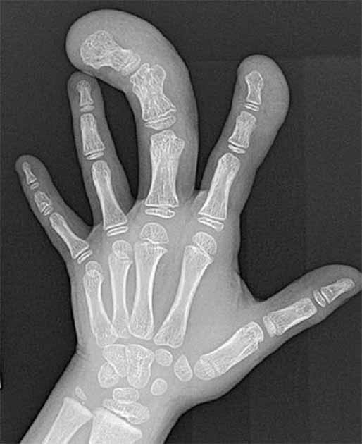 O mistério do dedo gigante radiograph | Bizarro | bizarro, dedo, egito, estranho, gigante, mistério, tumulos