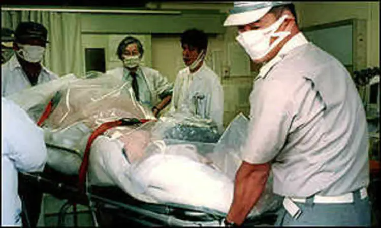 HISASHI OUCHI: a pessoa que tomou mais radiação no mundo e viveu por 83 dias Hisashi Ouchi Tokaimura Nuclear Accident 1.jpg | Bizarro | bizarro, curiosidades, japão, radiação