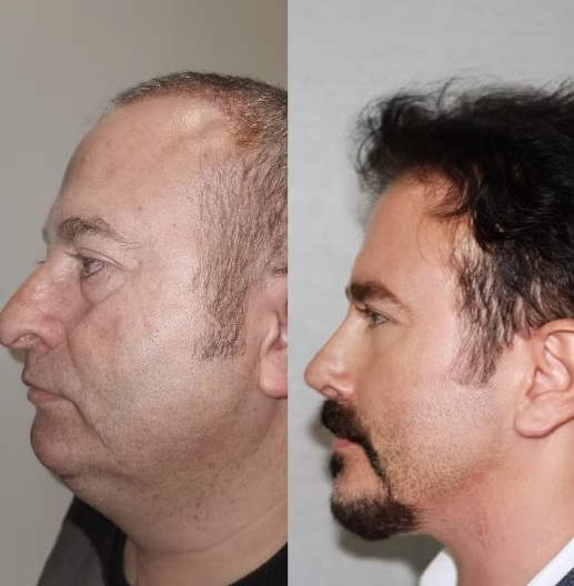 Clínica de cirurgia plástica se torna viral após "antes e depois" inacreditável Este Med plastic surgery2 | Incrível | bizarro, cirurgia, incrível, plastica