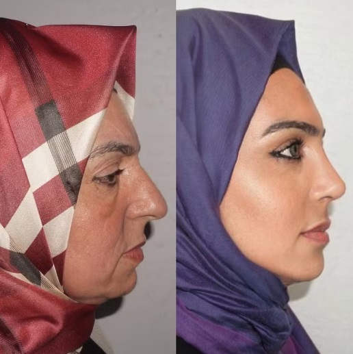 Clínica de cirurgia plástica se torna viral após "antes e depois" inacreditável Este Med plastic surgery4 | Incrível | bizarro, cirurgia, incrível, plastica