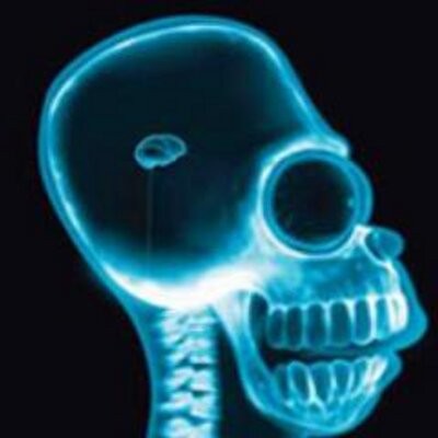 O intrigante caso do homem que tinha a cabeça vazia 3c363f6d06a89bb00d75ae4a99590864 | Bizarro | bizarro, cerebro, ciência, incrível, medicina