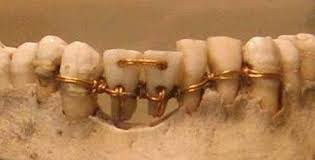O remédio que faz renascer os dentes perdidos dentes perdidos