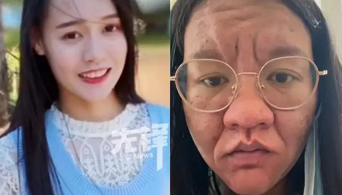 Impressionante: A bizarra transformação dessa mulher durante a gravidez pregnancy transformation | Incrível | buzarro, curioso, gravidez, incrível, medicina