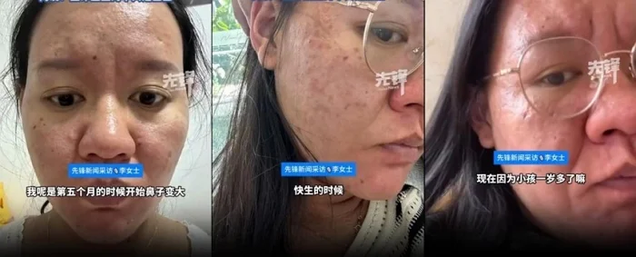 Impressionante: A bizarra transformação dessa mulher durante a gravidez pregnancy transformation2 | Incrível | buzarro, curioso, gravidez, incrível, medicina
